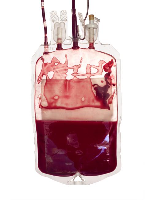 Red blood cells: Particulate matter | Professional Education